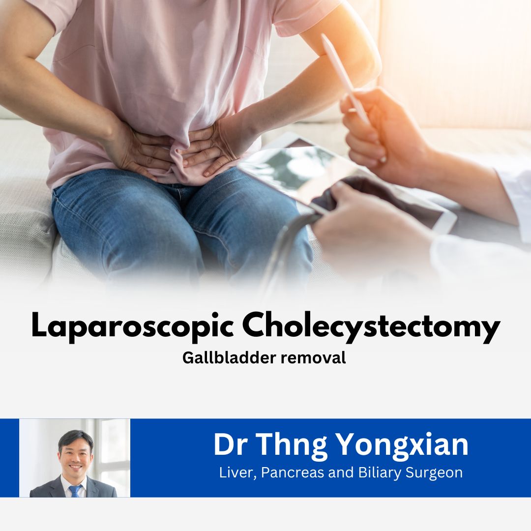 Nexus Surgical (SG) Laparoscopic Cholecystectomy